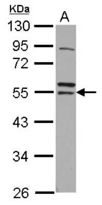 Western Blot: ARA54 Antibody [NBP2-15438]