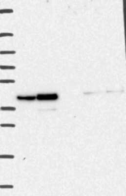 Western Blot: ARA54 Antibody [NBP3-17686]