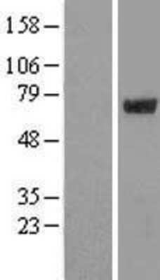 Western Blot: ARA54 Overexpression Lysate [NBL1-15425]