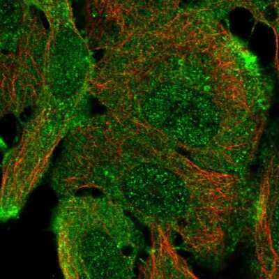 Immunocytochemistry/ Immunofluorescence: ARAP1 Antibody [NBP2-56429]