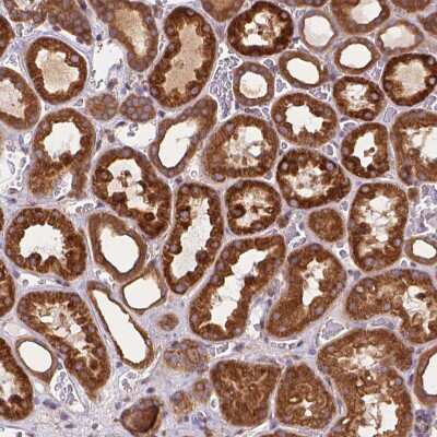 Immunohistochemistry-Paraffin: ARAP1 Antibody [NBP2-56429]