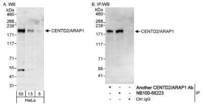 Western Blot: ARAP1 Antibody [NB100-68223]