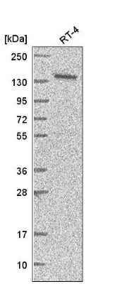 Western Blot: ARAP1 Antibody [NBP2-56429]