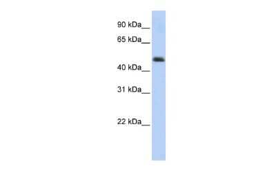 Western Blot: ARC/ARG3.1 Antibody [NBP1-56929]