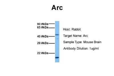 Western Blot: ARC/ARG3.1 Antibody [NBP2-87022]