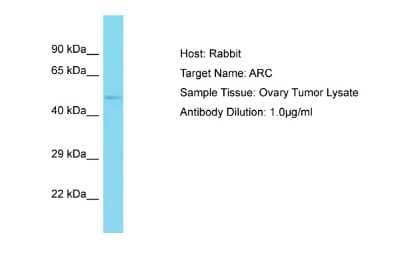 Western Blot: ARC/ARG3.1 Antibody [NBP2-87024]