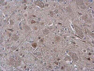 Immunohistochemistry-Paraffin: ARC/NOL3 Antibody [NBP2-19561]