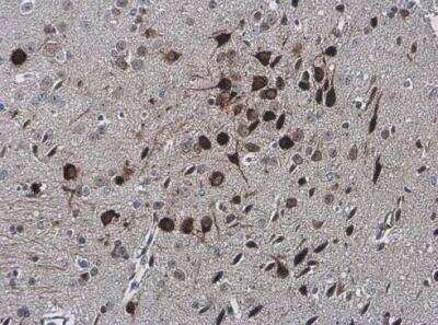 Immunohistochemistry-Paraffin: ARC/NOL3 Antibody [NBP2-19561]