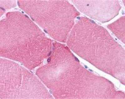 Immunohistochemistry-Paraffin: ARC/NOL3 Antibody - BSA Free [NBP2-41753]