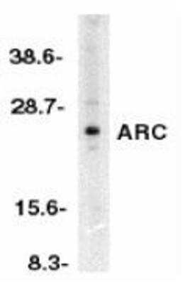 Western Blot: ARC/NOL3 AntibodyBSA Free [NBP1-76462]