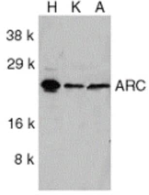 Western Blot: ARC/NOL3 AntibodyBSA Free [NBP2-41753]