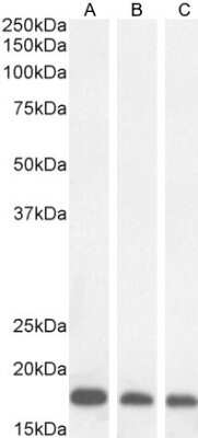 Western Blot: ARF1,2,3,4 Antibody [NB100-55421]