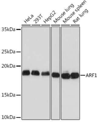 Western Blot: ARF1 Antibody (0C5B3) [NBP3-16782]