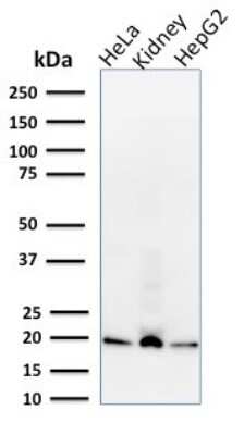 Western Blot: ARF1 Antibody (1A9/5) [NBP3-07760]