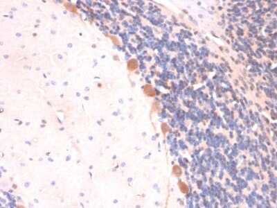 Immunohistochemistry-Paraffin: ARF1 Antibody (ARF1/2117) - Azide and BSA Free [NBP3-08473]