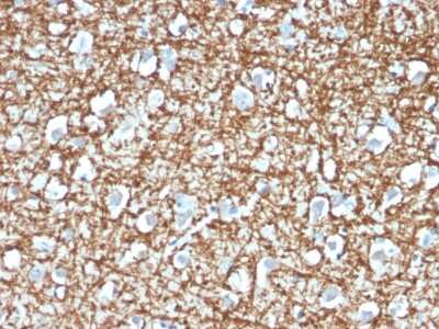 Immunohistochemistry-Paraffin: ARF1 Antibody (ARF1/2117) [NBP3-07774]