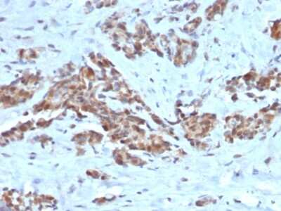 Immunohistochemistry-Paraffin: ARF1 Antibody (ARF1/2117) [NBP3-07774]