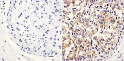 Immunohistochemistry-Paraffin: ARF1 Antibody [NBP2-29906]