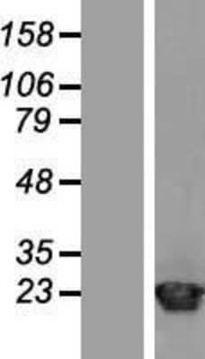 Western Blot: ARF1 Overexpression Lysate [NBL1-07650]