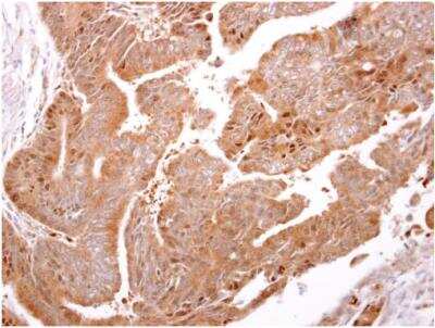 Immunohistochemistry-Paraffin: ARF3 Antibody [NBP1-31004]