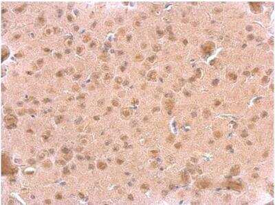 Immunohistochemistry-Paraffin: ARF3 Antibody [NBP1-31004]