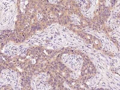 Immunohistochemistry-Paraffin: ARF3 Antibody [NBP2-99493]