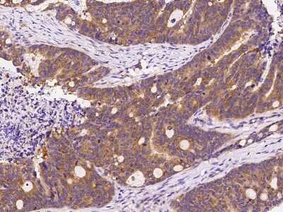 Immunohistochemistry-Paraffin: ARF3 Antibody [NBP2-99493]