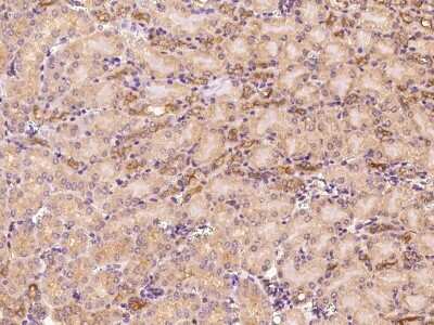 Immunohistochemistry-Paraffin: ARF3 Antibody [NBP2-99493]