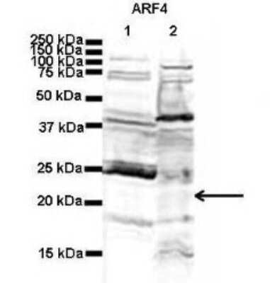 Western Blot: ARF4 Antibody [NBP1-79614]