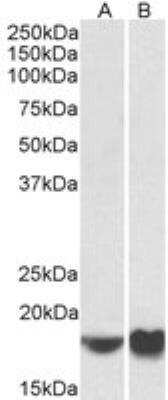 Western Blot: ARF4 Antibody [NBP2-26147]