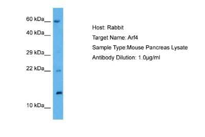 Western Blot: ARF4 Antibody [NBP2-86578]