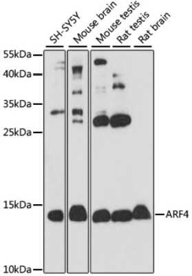 Western Blot: ARF4 AntibodyAzide and BSA Free [NBP2-92502]