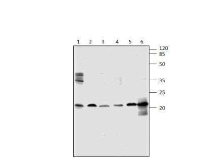 Western Blot: ARF4 Antibody [NBP3-12381]