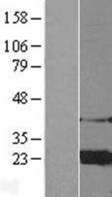 Western Blot: ARF4 Overexpression Lysate [NBL1-07652]