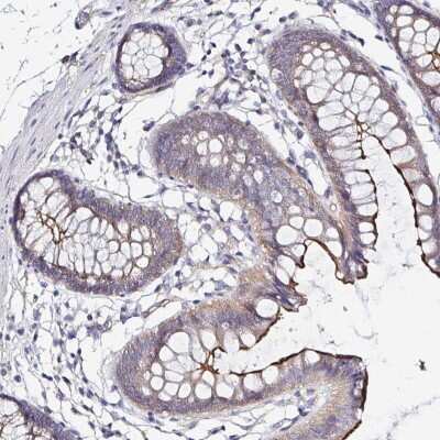Immunohistochemistry-Paraffin: ARF4L Antibody [NBP2-31820]