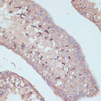 Immunohistochemistry-Paraffin: ARF4L Antibody - Azide and BSA Free [NBP2-92876]