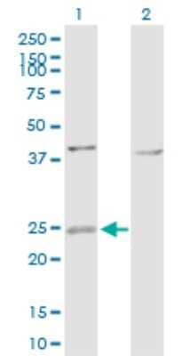 Western Blot: ARF4L Antibody [H00000379-D01P]