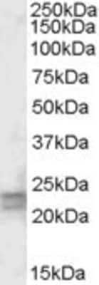 Western Blot: ARF4L Antibody [NBP1-51927]