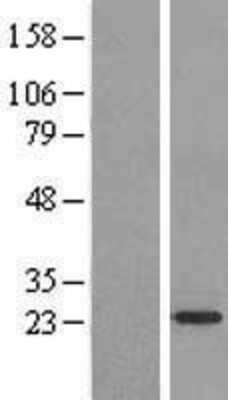 Western Blot: ARF4L Overexpression Lysate [NBL1-07696]