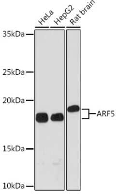 Western Blot: ARF5 Antibody (0U0D2) [NBP3-16177]