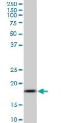 Western Blot: ARF5 Antibody (1B4) [H00000381-M01]