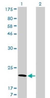 Western Blot: ARF5 Antibody (1B4) [H00000381-M01]