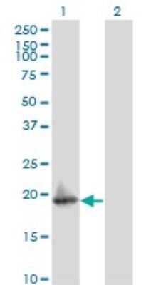 Western Blot: ARF5 Antibody (1B6) [H00000381-M02]