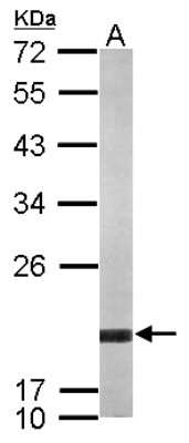 Western Blot: ARF5 Antibody [NBP2-15440]