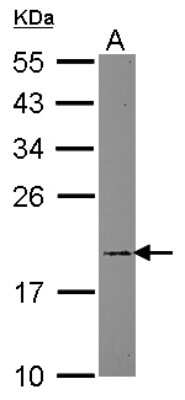 Western Blot: ARF5 Antibody [NBP2-15440]