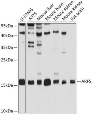 Western Blot: ARF5 AntibodyBSA Free [NBP2-92645]