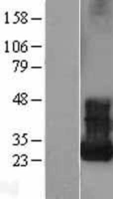 Western Blot: ARF5 Overexpression Lysate [NBL1-07653]