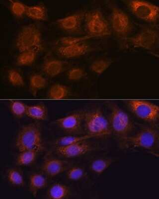 Immunocytochemistry/ Immunofluorescence: ARF6 Antibody (9E7T9) [NBP3-15391]