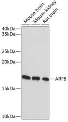 Western Blot: ARF6 Antibody (9E7T9) [NBP3-15391]