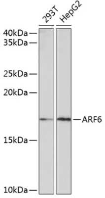 Western Blot: ARF6 Antibody (9E7T9) [NBP3-15391]